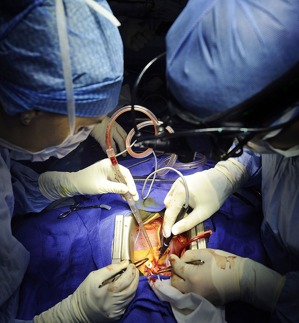 cardiac bypass surgery
